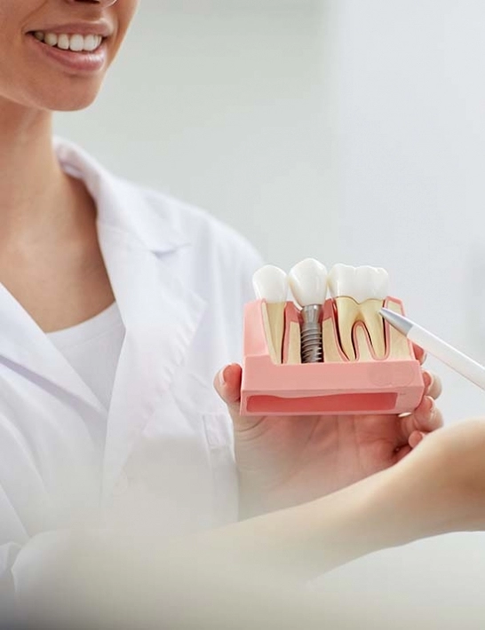 Implante dentário em São Carlos