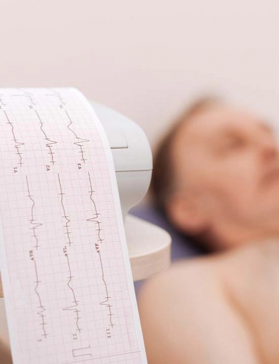 Eletrocardiograma em São Carlos