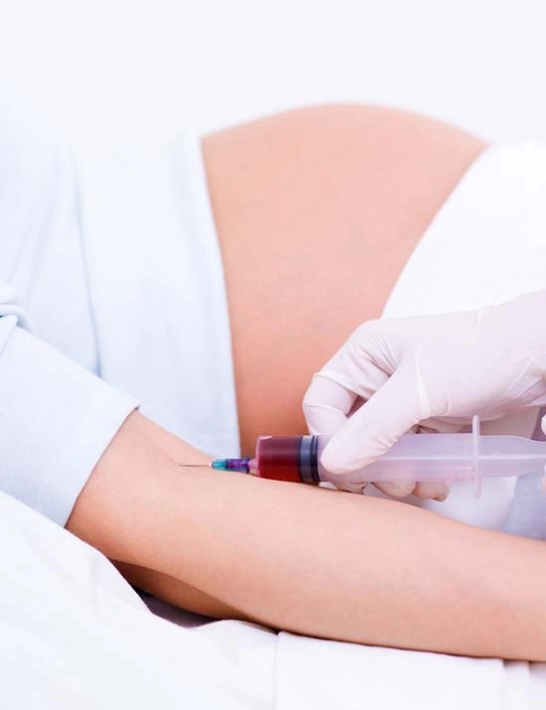 Sexagem fetal