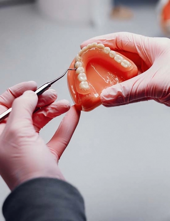 Prótese dentária em São Carlos